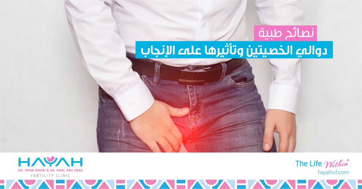 Varicocele and Its Effect on Fertility