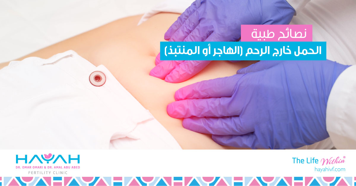 Ectopic Pregnancy